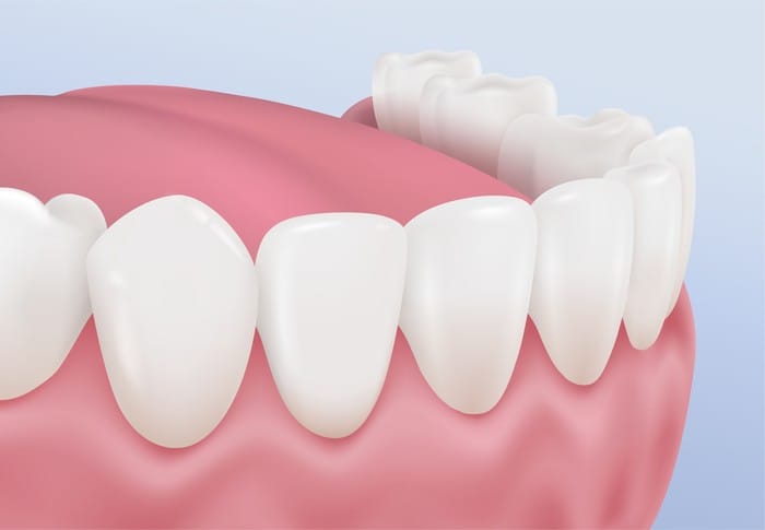仕上がりを3Dシミュレーションで確認できる